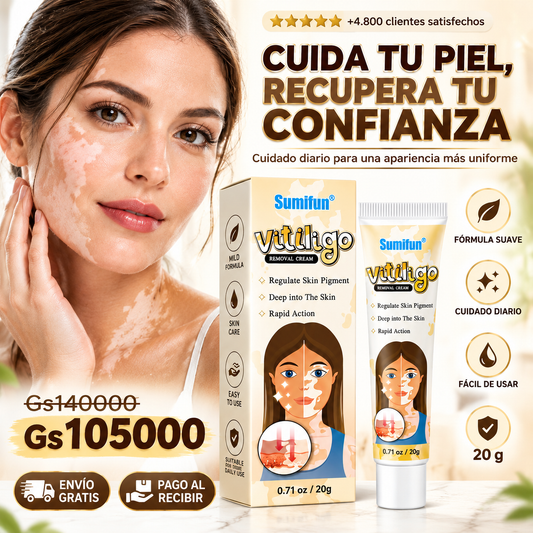 Sumifun Vitiligo Removal Cream 20 g